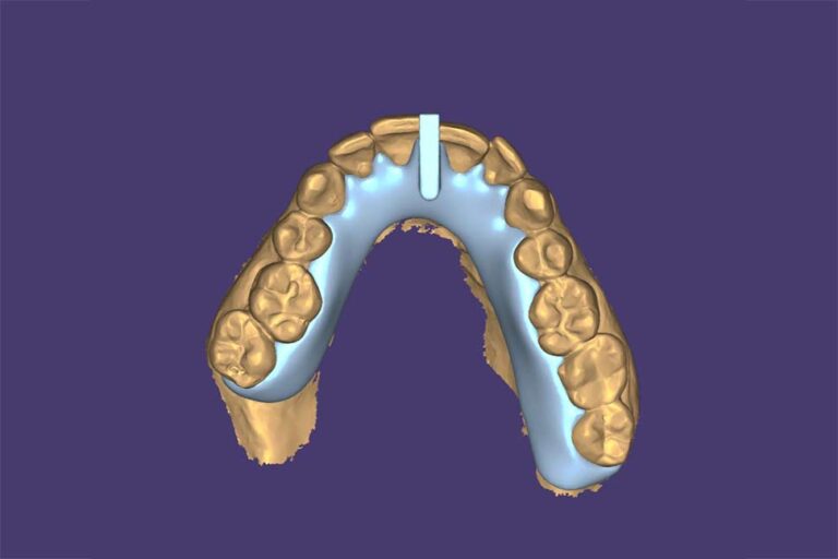 How Long Should You Wear a KOIS Deprogrammer?