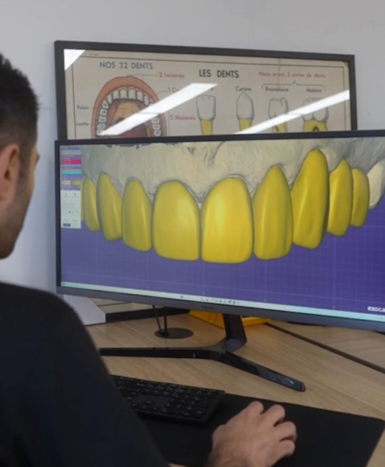 5 Reasons Dentists Are Switching to Digital Smile Design