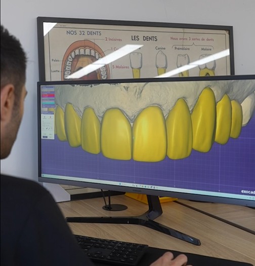 Boosting Case Value with Digital Smile Design