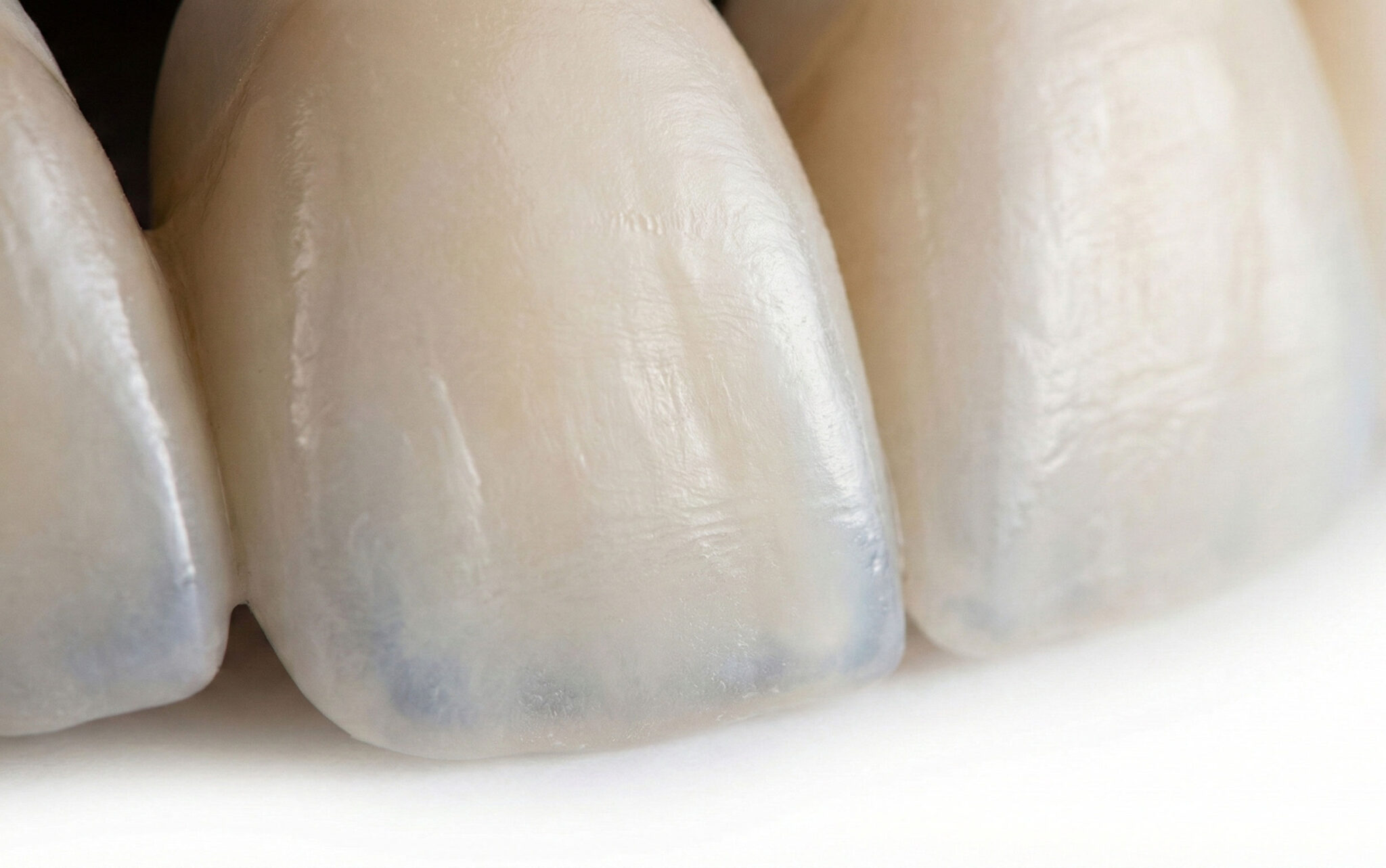 Leading Dental Laboratory in Sydney | Smile Art Lab