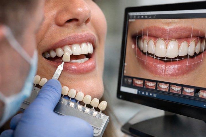 5 Common Errors Dentists Make with DSD