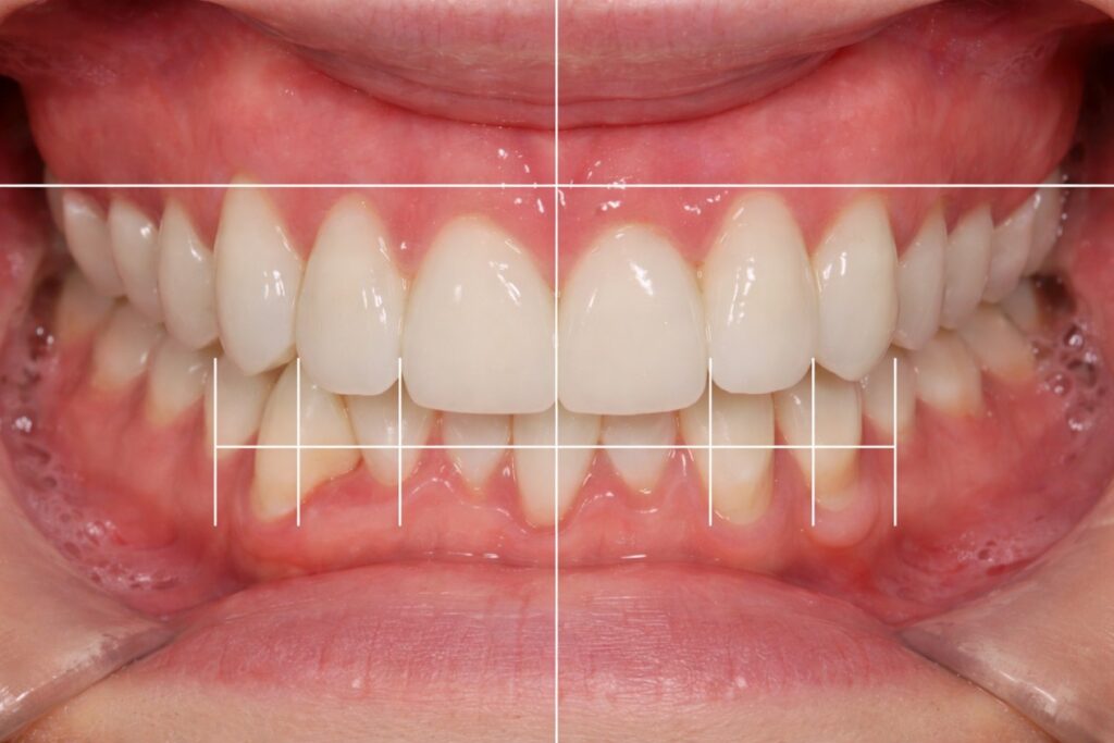 7 Clinical Advantages of Using DSD in Modern Dental Practices