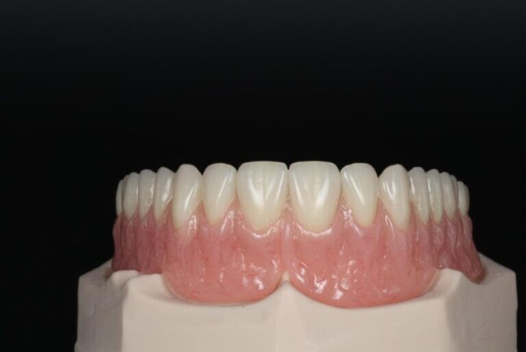 How Digital Smile Design Takes a Case From Records to Restoration