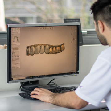 Smile Art Lab’s Smile Design service in Canberra utilizes 3D digital wax-up technology to create visual representations of the expected outcomes. This innovative approach allows both dentists and patients to visualize the final result before treatment begins. By combining patient photos with advanced technology, we create detailed and personalized treatment plans, ensuring optimal aesthetic results. Our Smile Design service boosts patient confidence by providing a clear preview of their new smile, making Smile Art Lab a trusted partner for Canberra dental professionals.